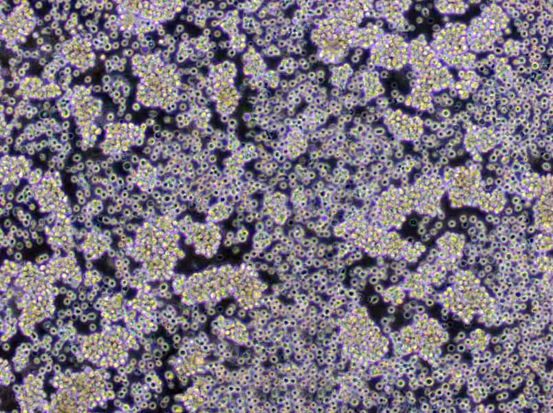 脑-心浸萃液态培养基基础