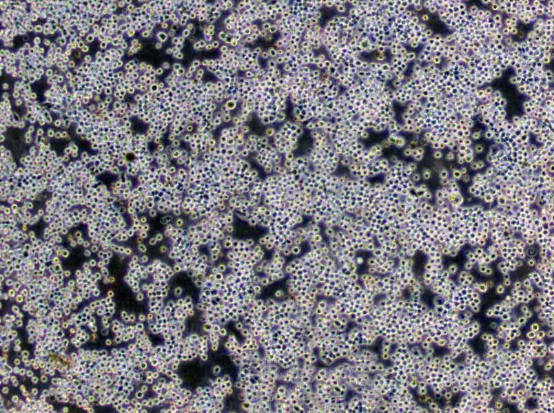选择性APS超级肉汤培养基基础