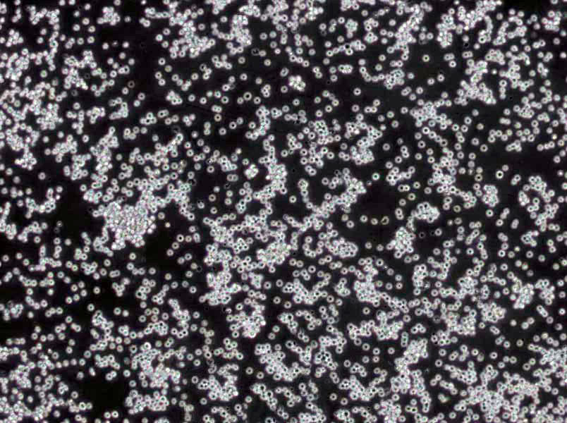 克氏双糖铁琼脂培养基基础