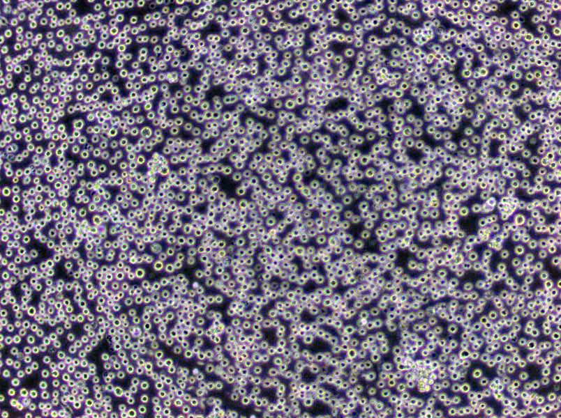 CCFA琼脂基础培养基