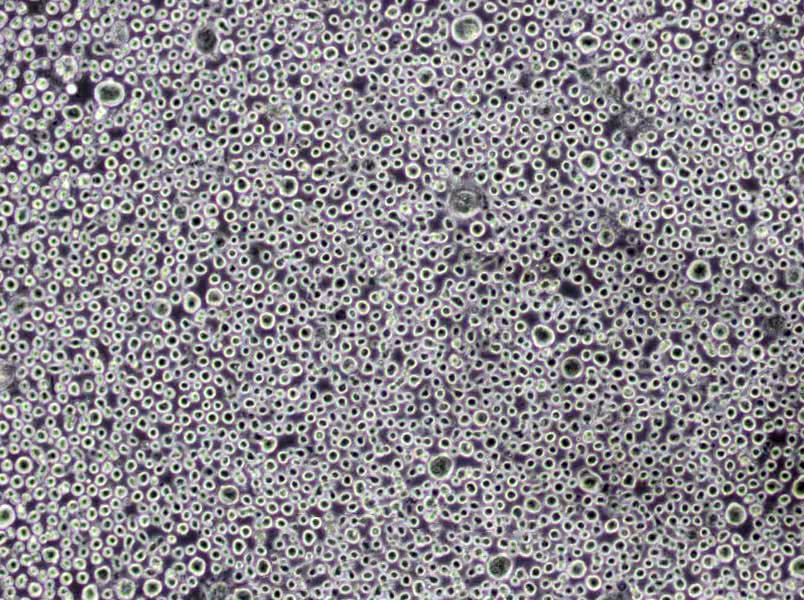 心浸夜琼脂基础培养基