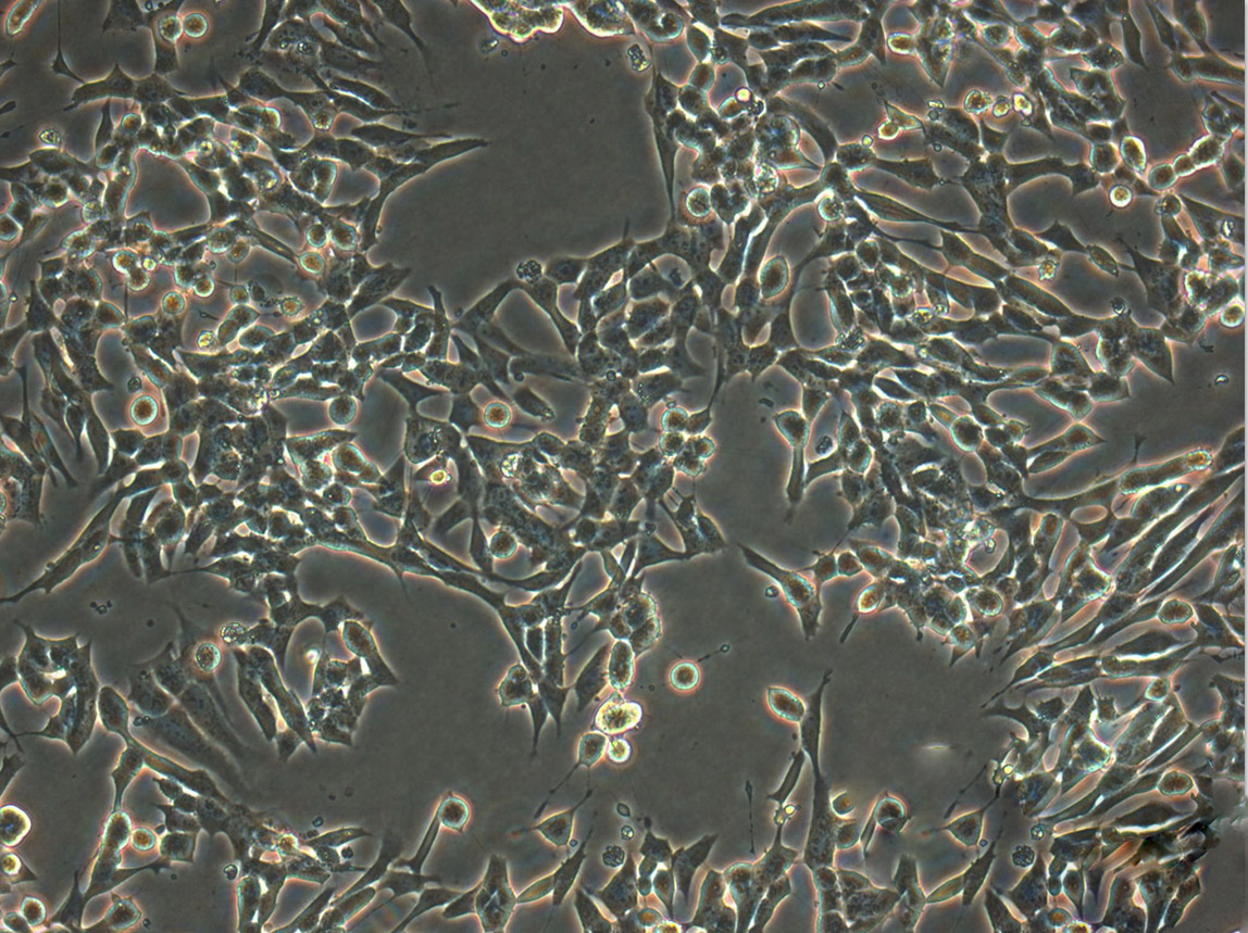 SW620 Epithelial Cell|人结肠癌传代细胞(有STR鉴定)