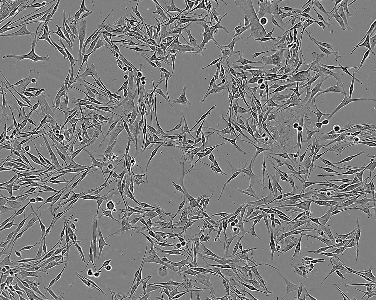KYSE-520 Epithelial Cell|人食管鳞癌传代细胞(有STR鉴定)
