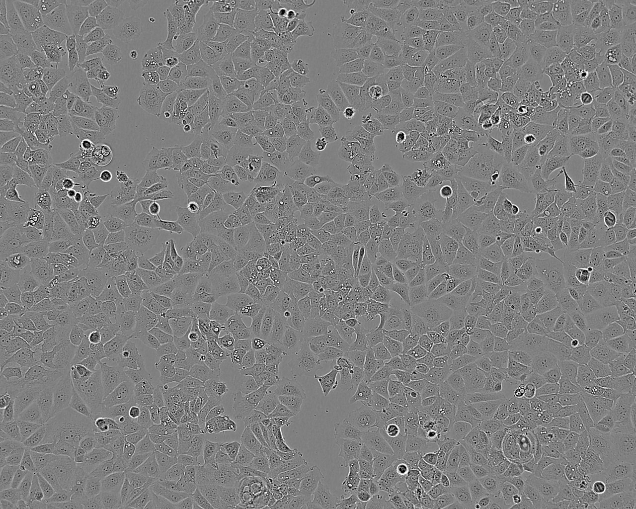 NCI-H498 Epithelial Cell|人结直肠腺癌传代细胞(有STR鉴定)
