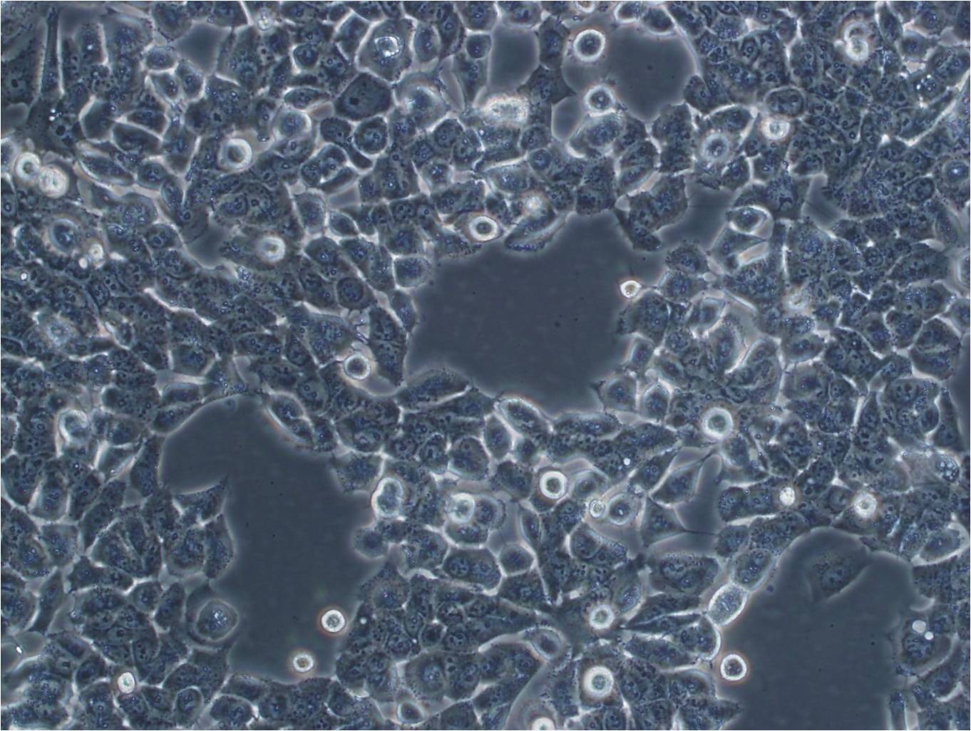 HEp-2 Epithelial Cell|人喉表皮样癌传代细胞(有STR鉴定)