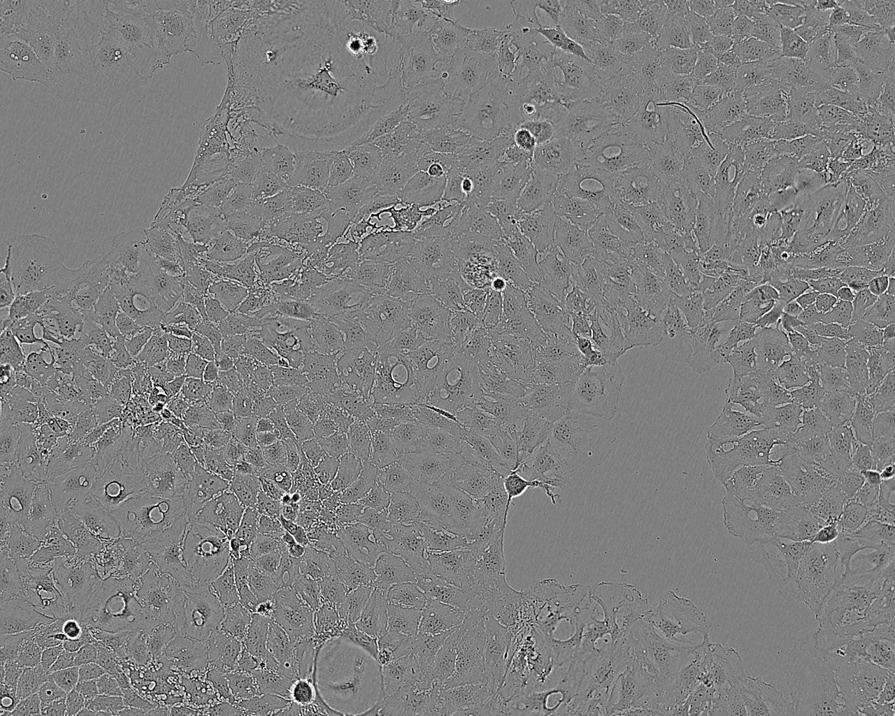 Caki-1 Epithelial Cell|人肾透明细胞癌传代细胞(有STR鉴定)