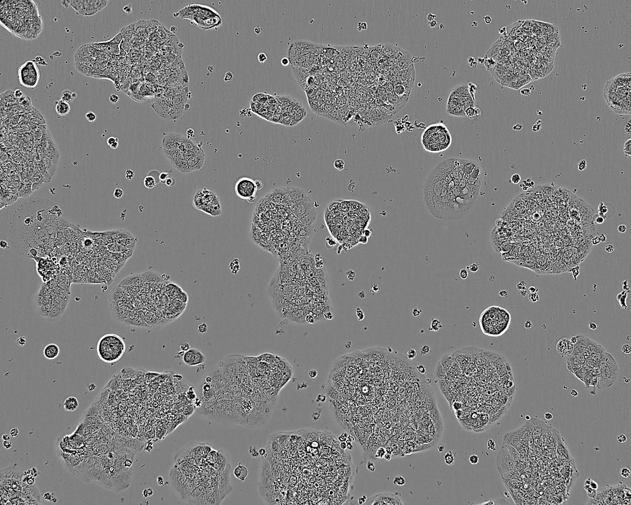 SCC-4 Epithelial Cell|人类鳞状上皮舌癌传代细胞(有STR鉴定)