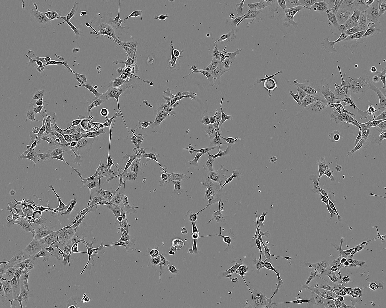 SK-NEP-1 Epithelial Cell|人肾母细胞瘤传代细胞(有STR鉴定)