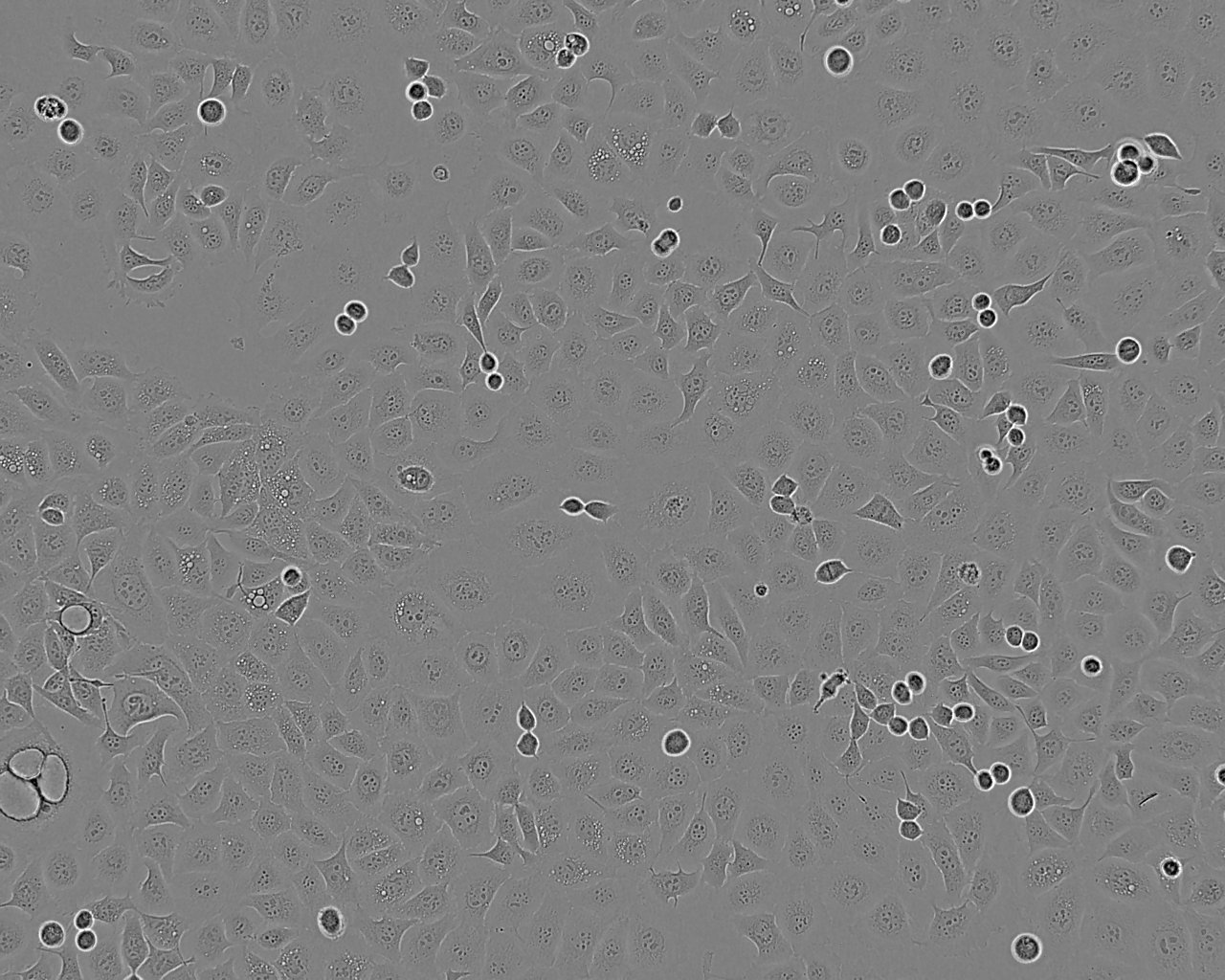 NCI-H596 Epithelial Cell|人肺腺鳞癌传代细胞(有STR鉴定)