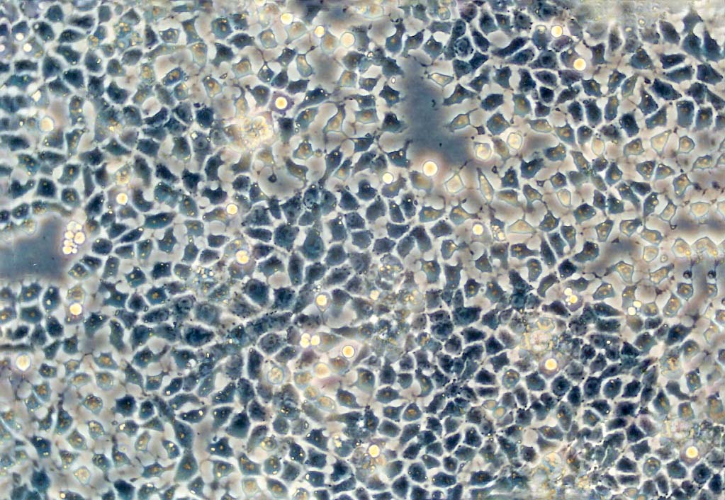 COR-L23 Epithelial Cell|人肺癌传代细胞(有STR鉴定)