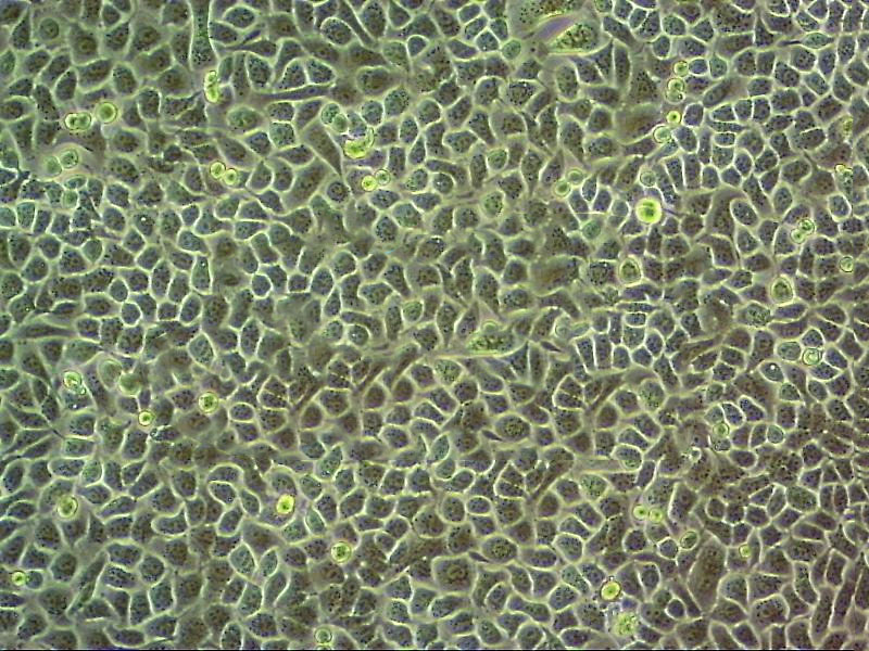 NCI-H647 Epithelial Cell|人非小细胞肺癌传代细胞(有STR鉴定)