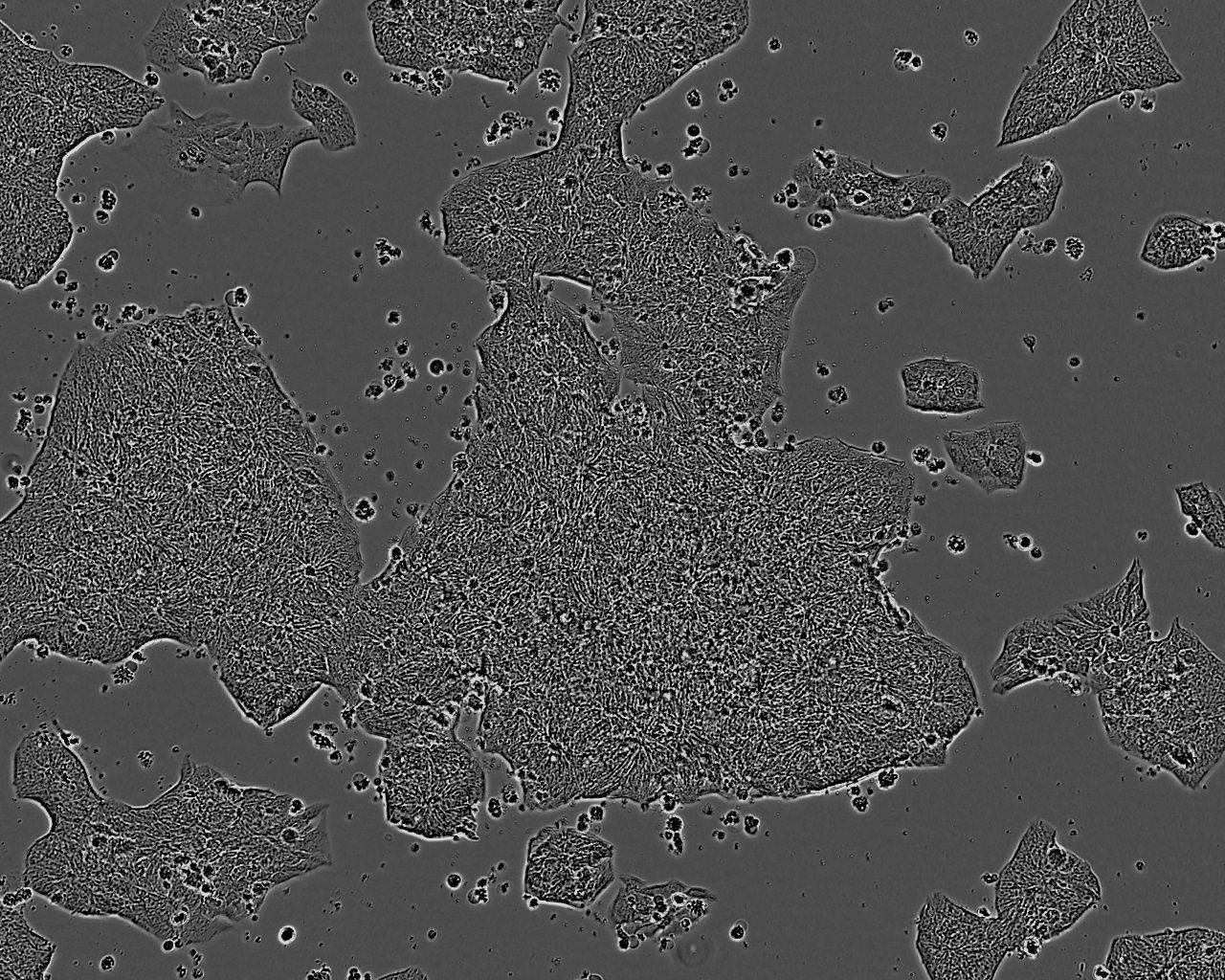 NCI-H1341 Epithelial Cell|人小细胞肺癌传代细胞(有STR鉴定)