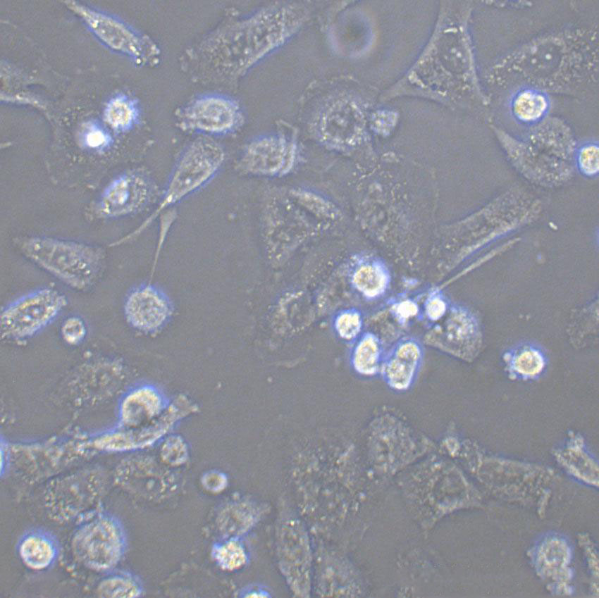 NCI-H2029 Epithelial Cell|人小细胞肺癌传代细胞(有STR鉴定)