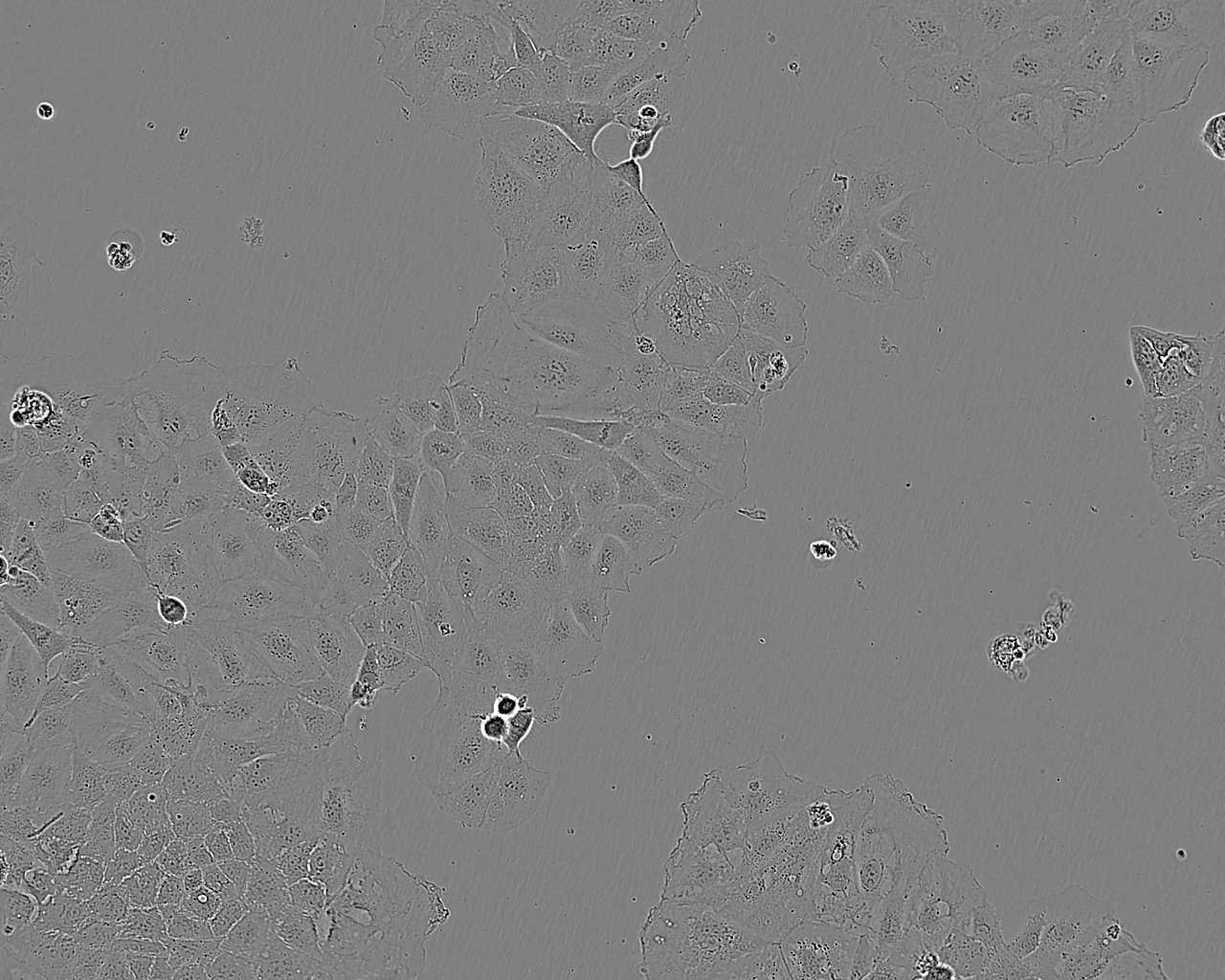 NCI-H2141 Epithelial Cell|人小细胞肺癌传代细胞(有STR鉴定)
