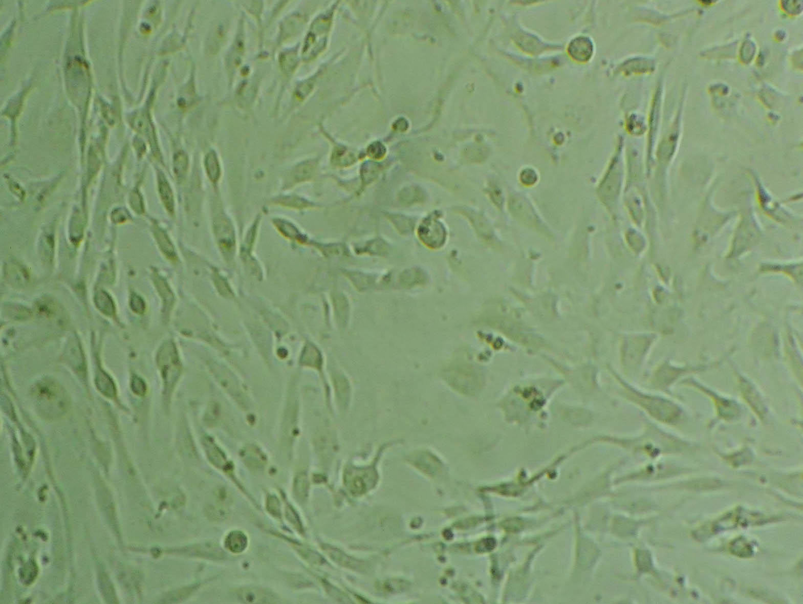 SHP-77 Epithelial Cell|人肺癌传代细胞(有STR鉴定)