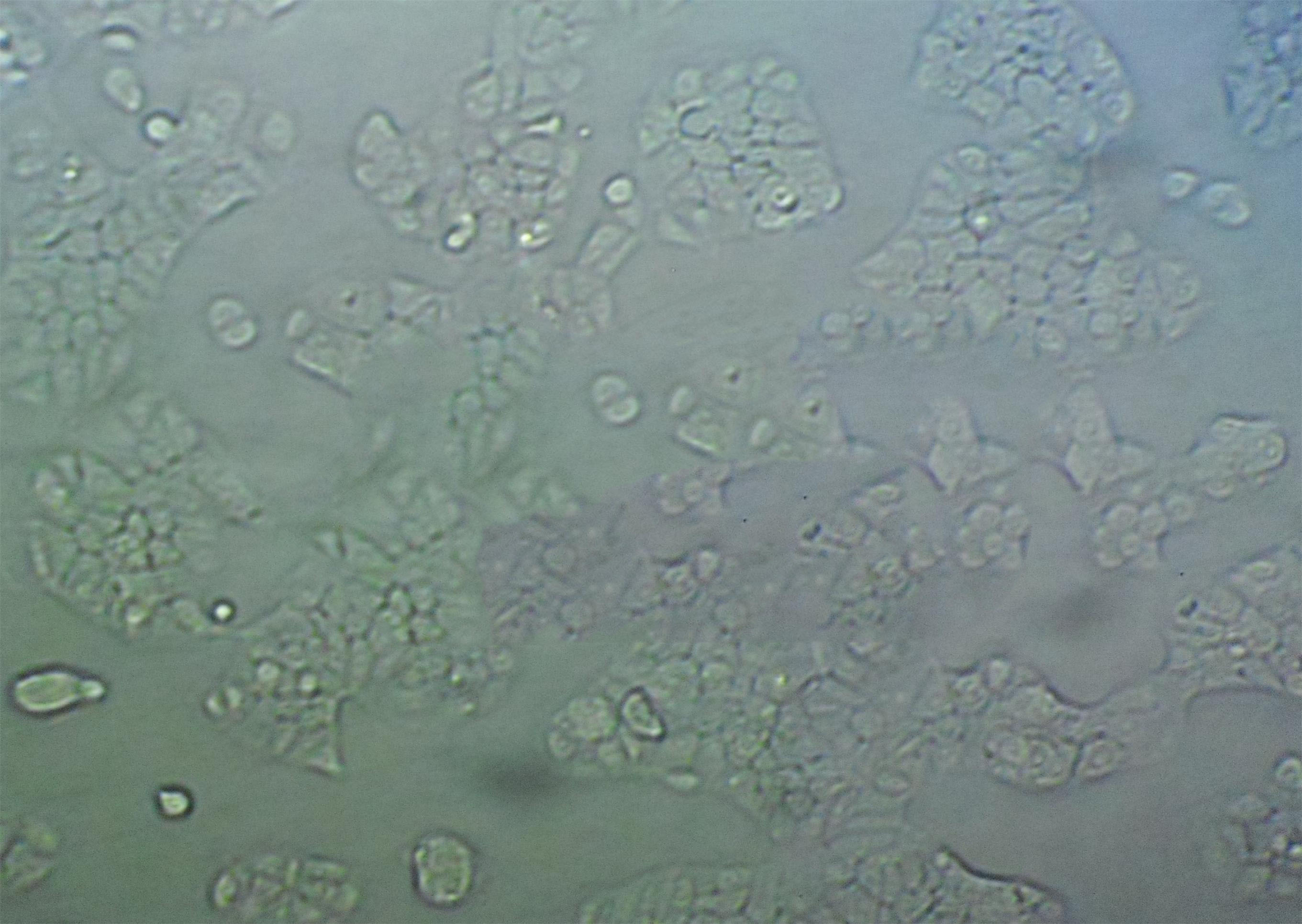 ARIP Epithelial Cell|人胰腺肿瘤传代细胞(有STR鉴定)