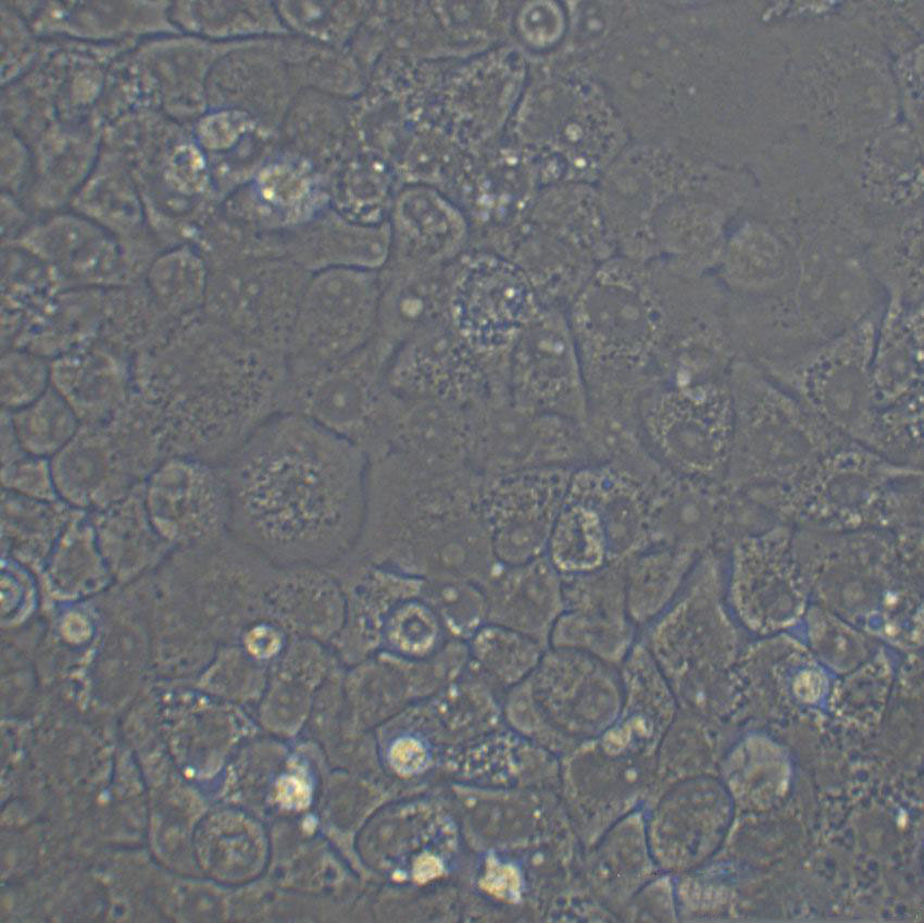 A-498 Epithelial Cell|人肾癌传代细胞(有STR鉴定)