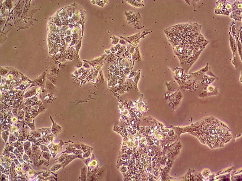 HOP-92 Epithelial Cell|人小细胞肺癌传代细胞(有STR鉴定)