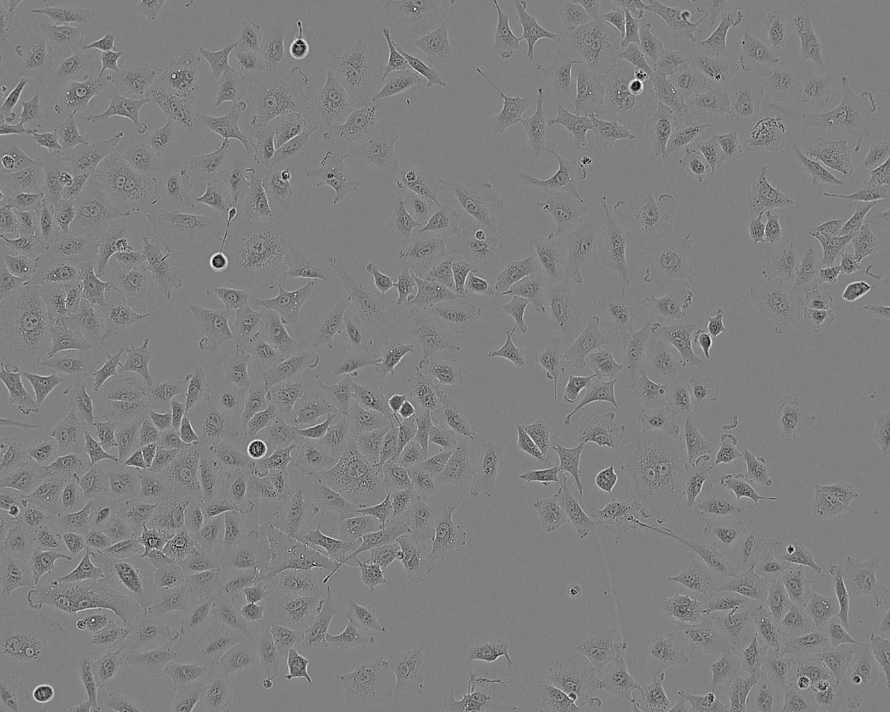SNU-719 Epithelial Cell|人胃癌传代细胞(有STR鉴定)