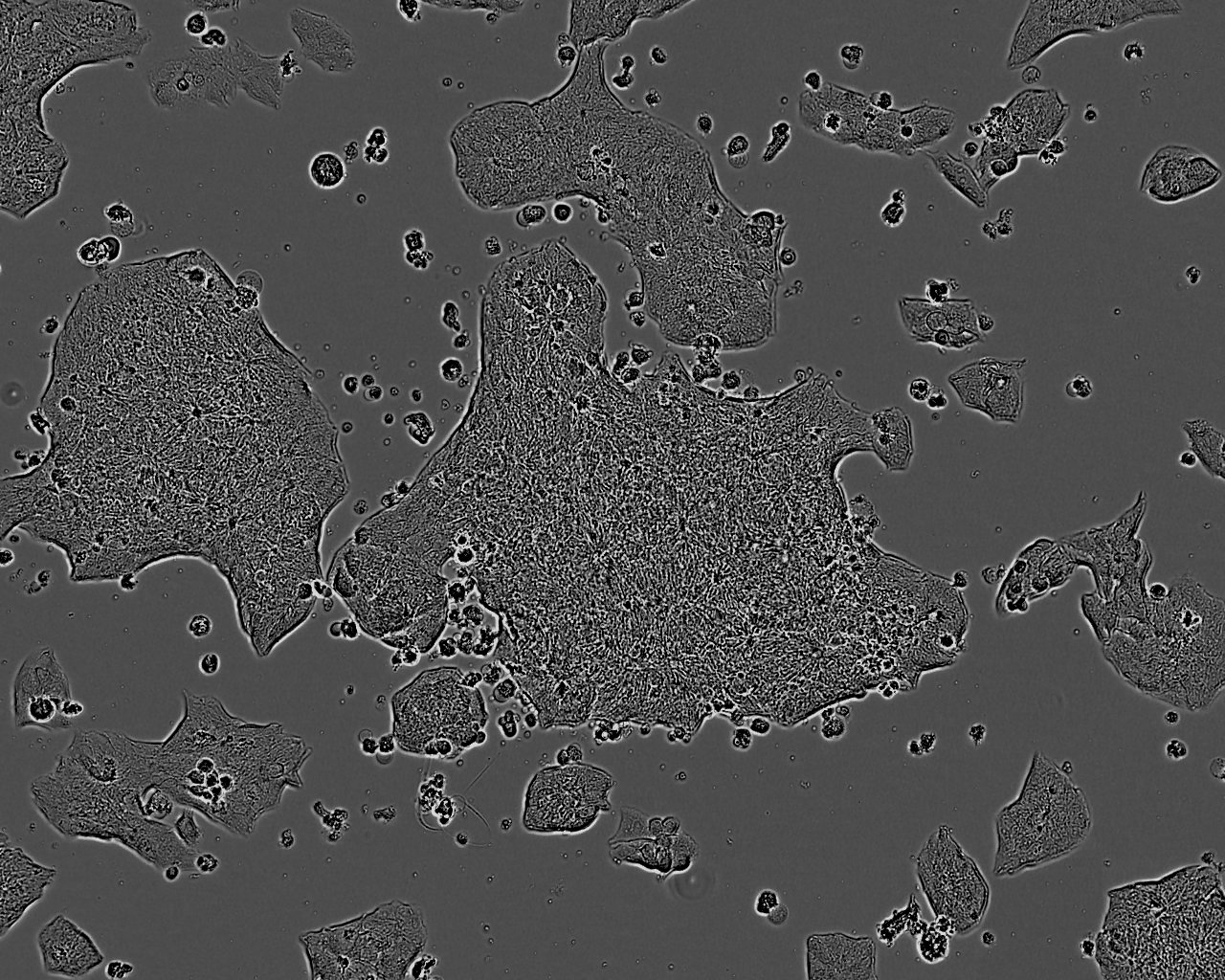 NCM460 Fresh Cells|结直肠腺癌细胞(送STR基因图谱)