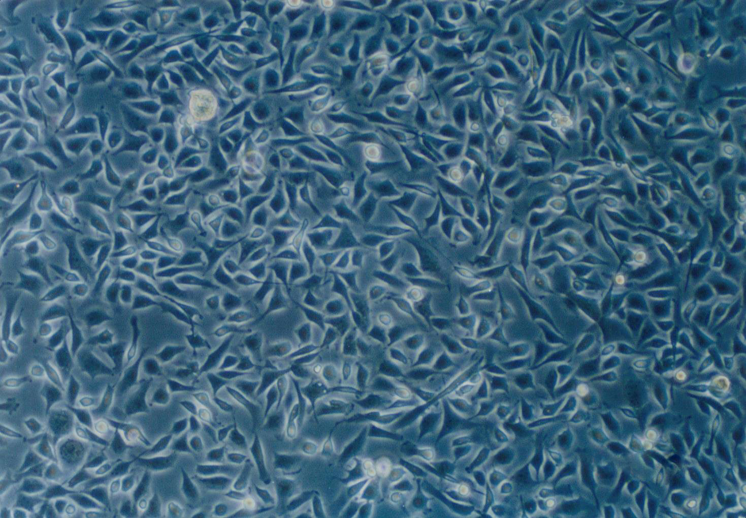H9c2(2-1) Fresh Cells|大鼠胚胎心肌细胞(送STR基因图谱)