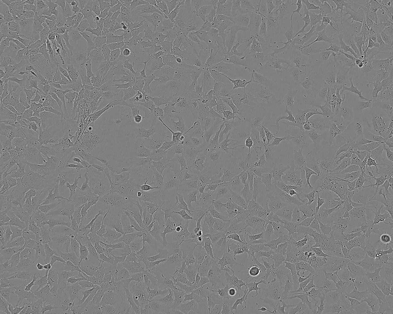 EO771 Fresh Cells|小鼠髓样乳腺癌细胞(送STR基因图谱)