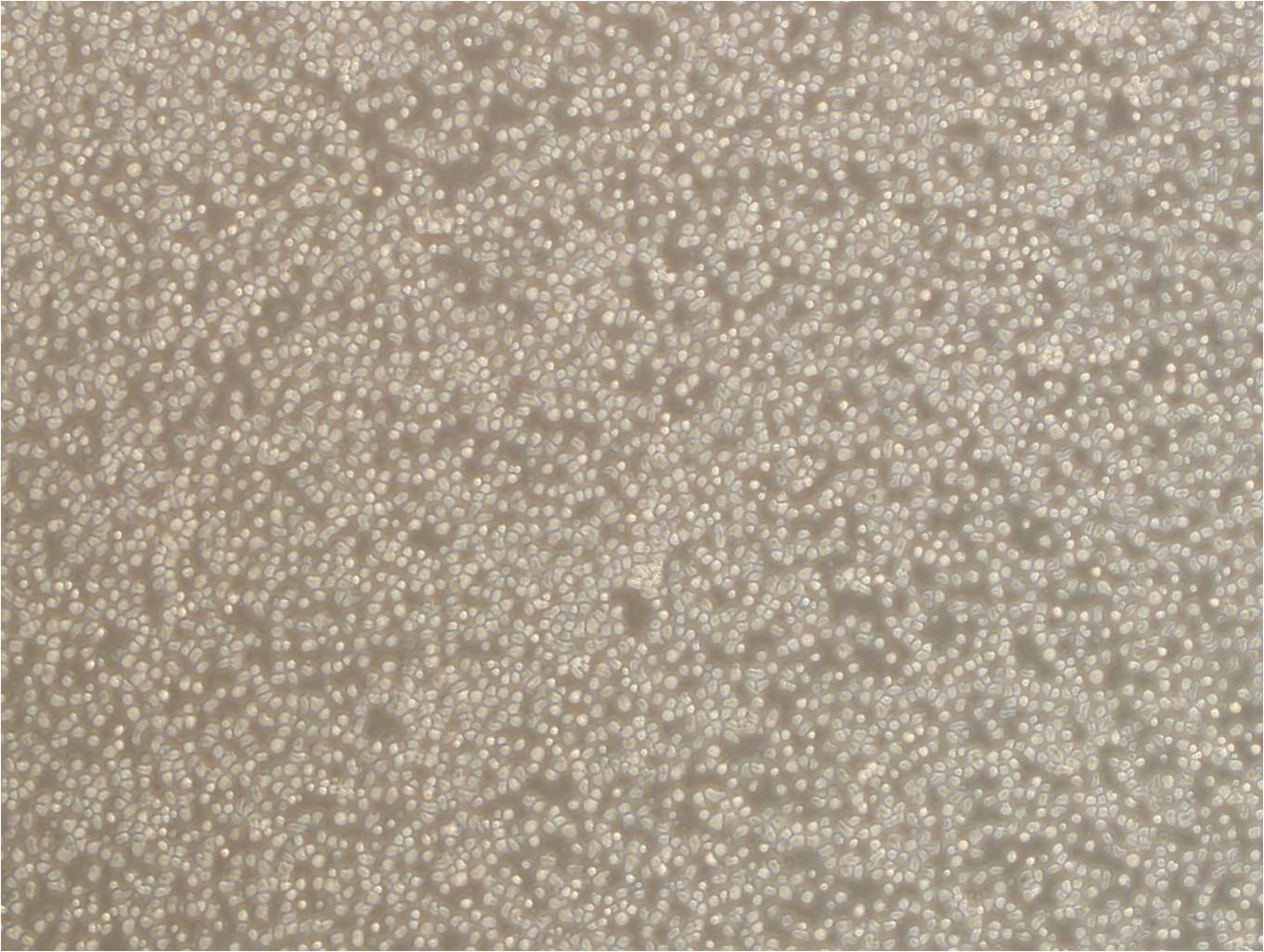 Anti-WDR61:WD重复膜蛋白61抗体