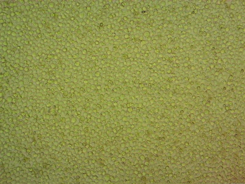 Anti-TIE1:血管生成素受体1抗体