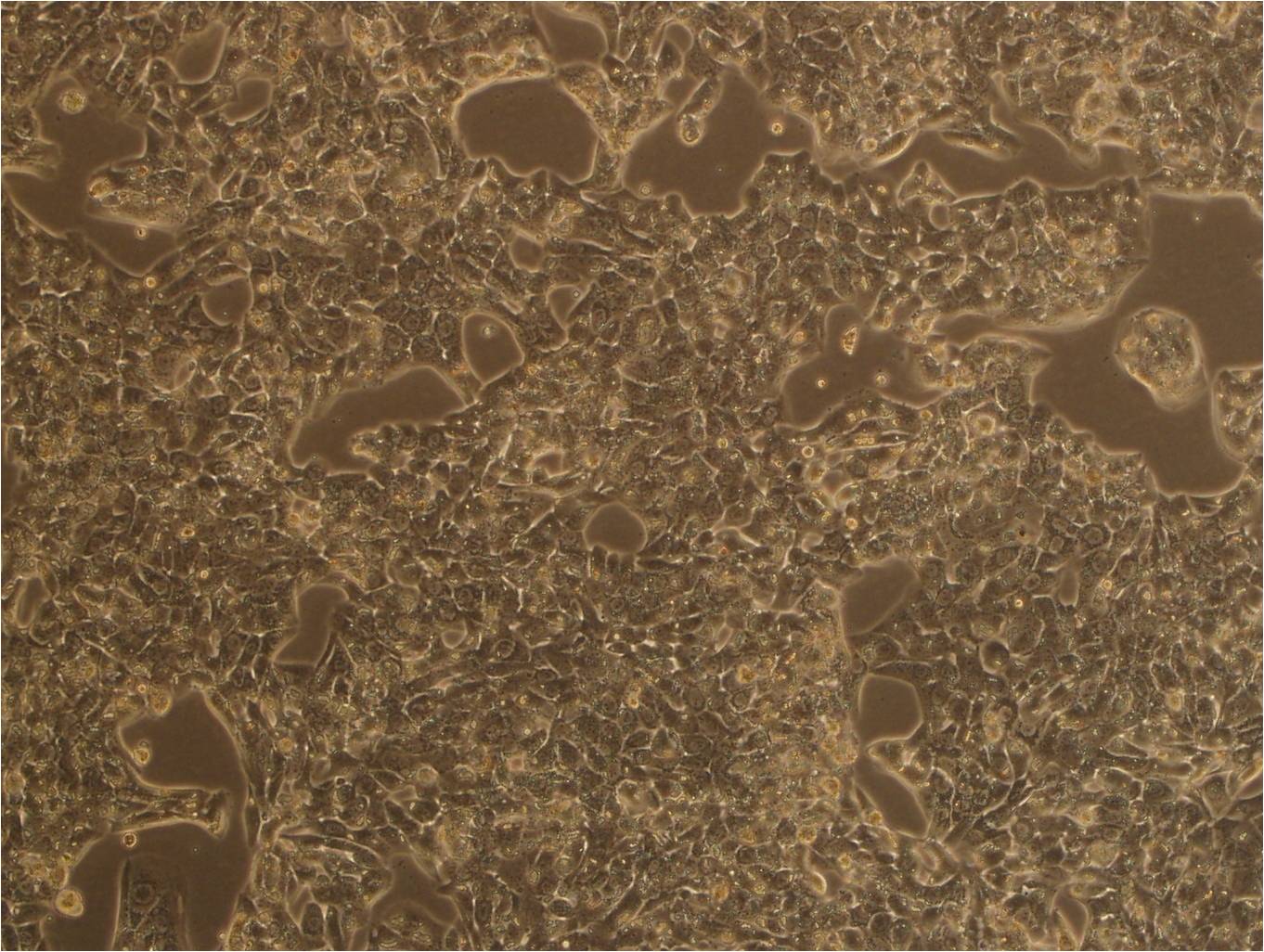 ACC-3 Cells|人涎腺腺样囊性癌克隆细胞(包送STR鉴定报告)