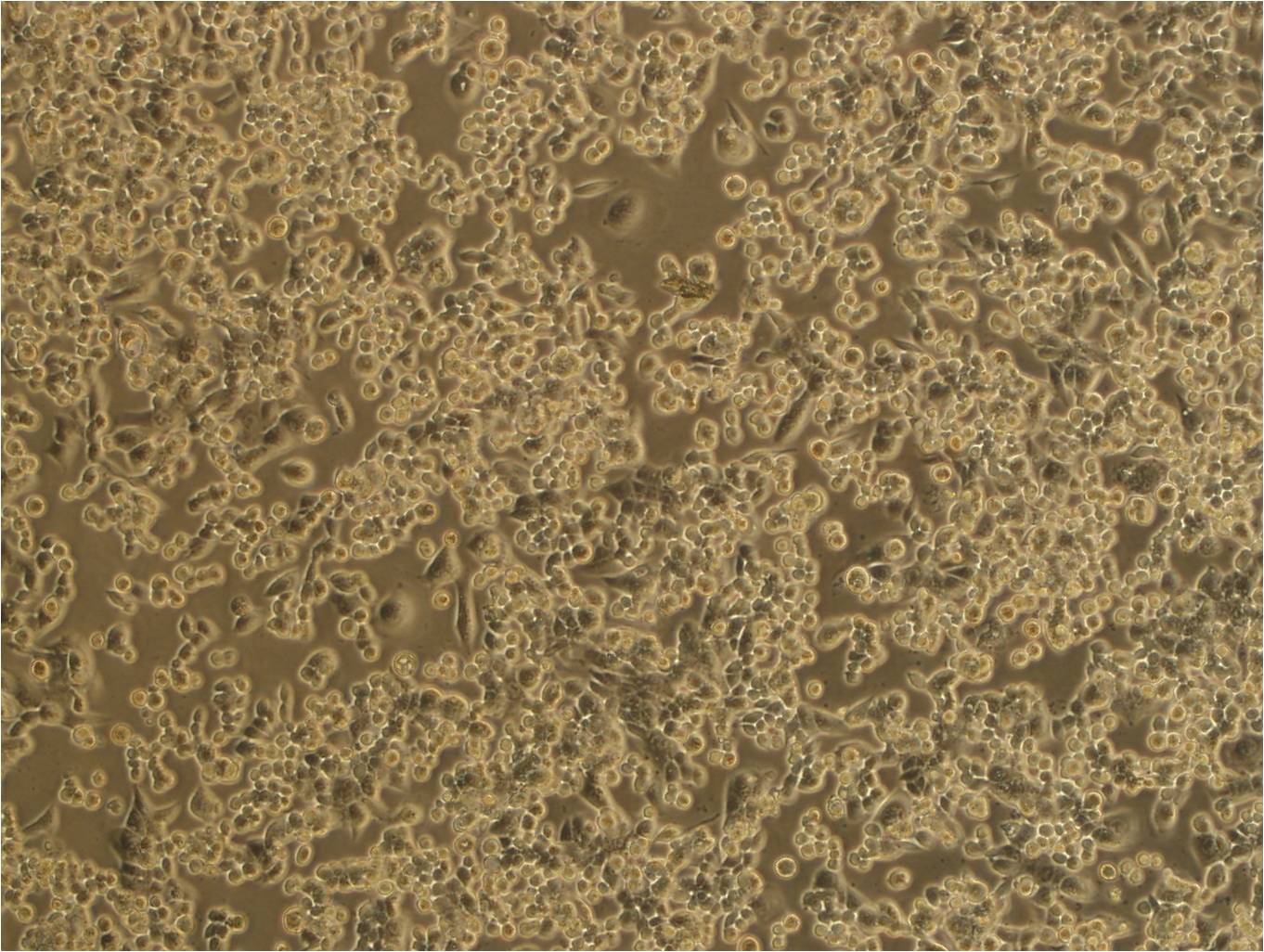 NIT-1:小鼠胰腺β复苏细胞(提供STR鉴定图谱)