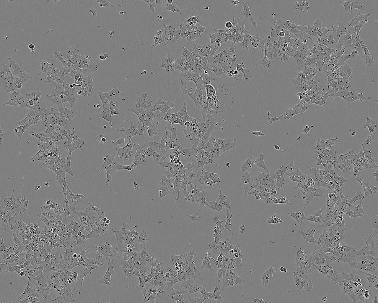 NMC-G1:人脑胶质复苏细胞(提供STR鉴定图谱)