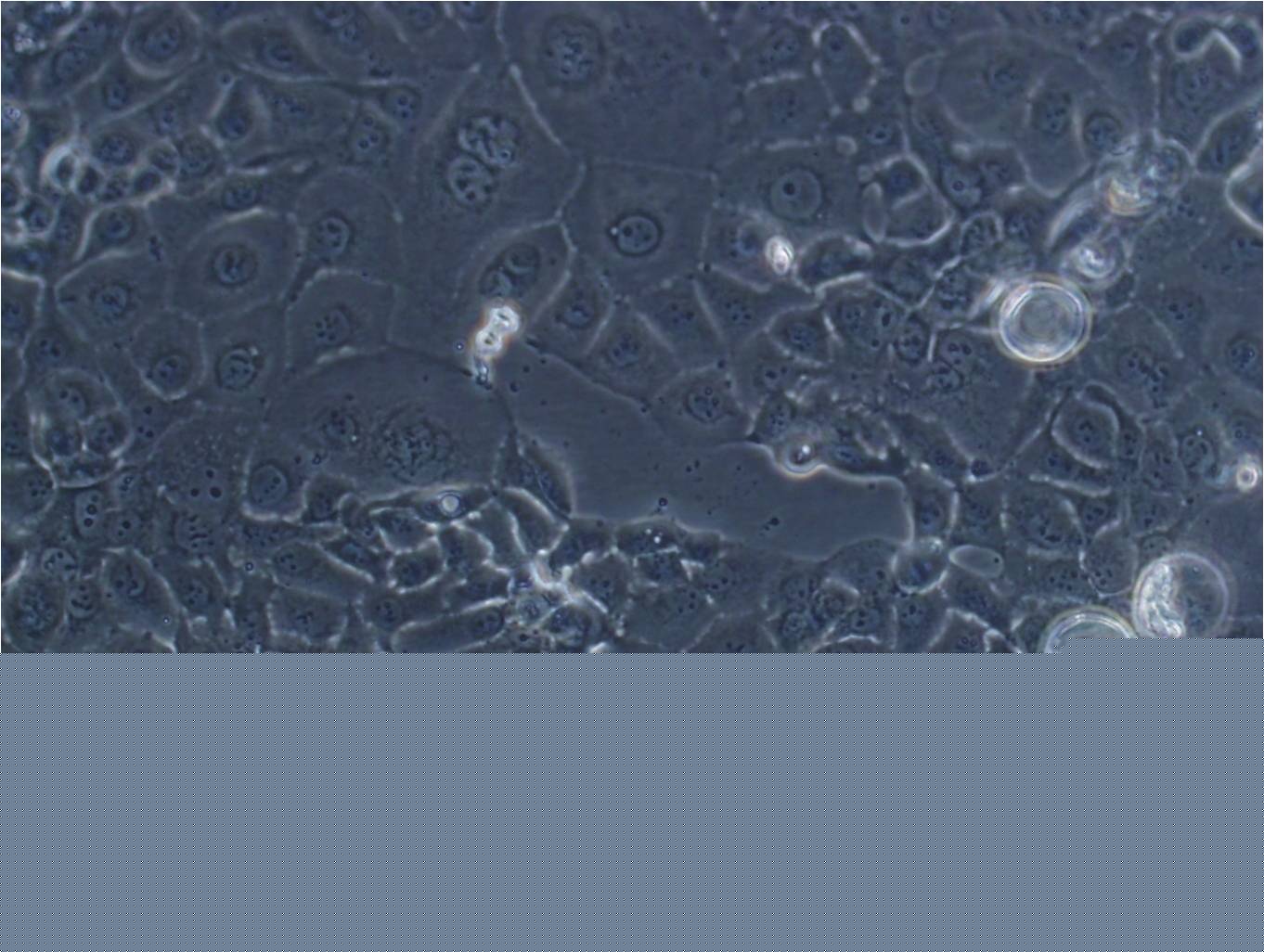 AR42J:大鼠胰腺外分泌腺肿瘤复苏细胞(提供STR鉴定图谱)