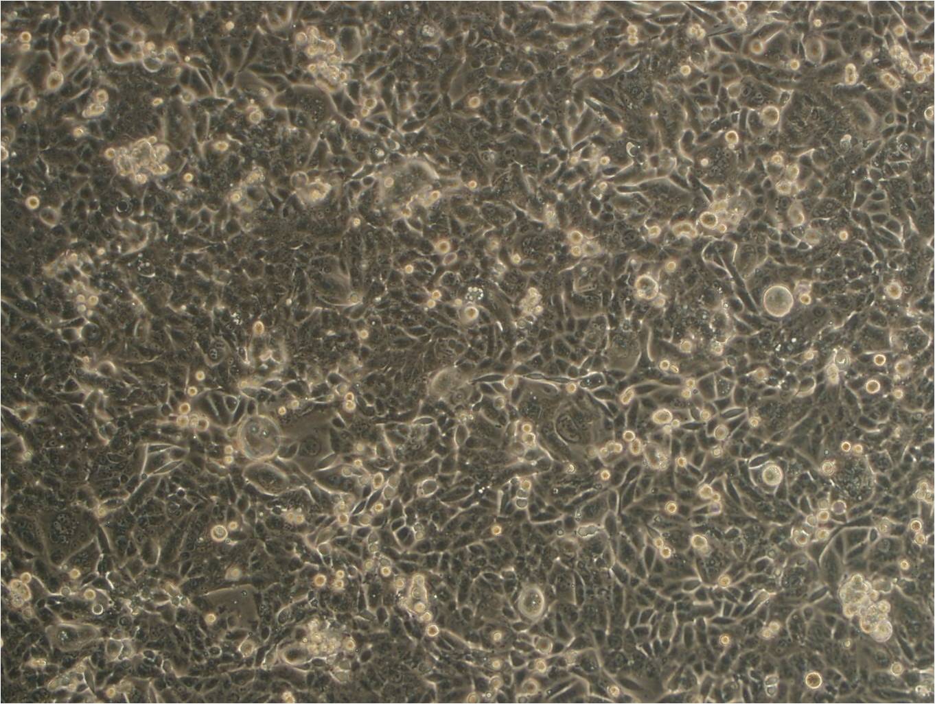 HMEC-1:人微血管内皮复苏细胞(提供STR鉴定图谱)