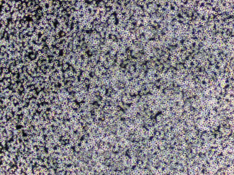 BJAB Cells(赠送Str鉴定报告)|人Burkitt's淋巴瘤细胞