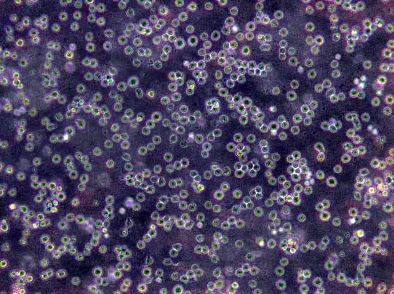 P116 Cells(赠送Str鉴定报告)|人急性淋巴白血病细胞