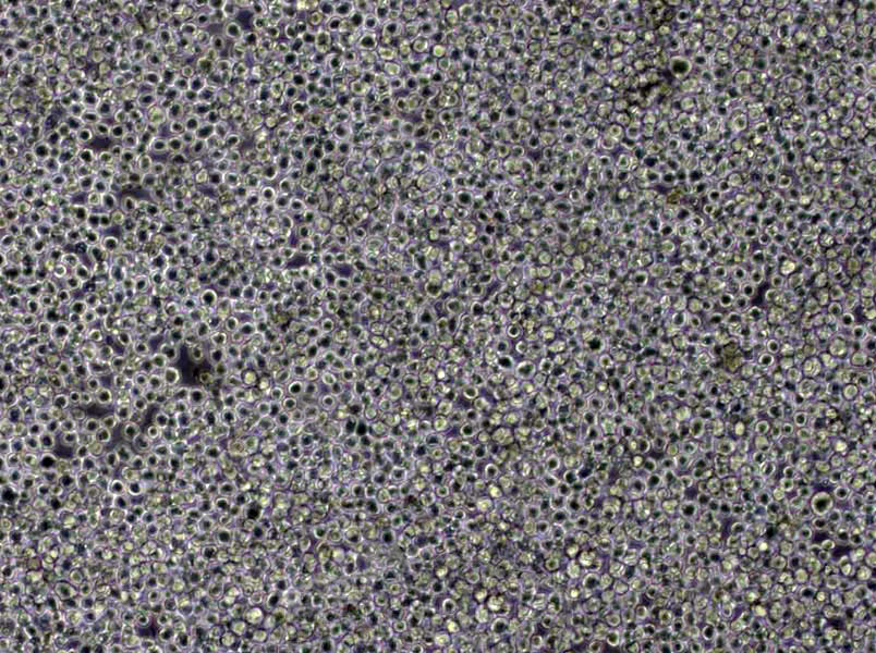 MLMA Cells(赠送Str鉴定报告)|人恶性淋巴瘤细胞