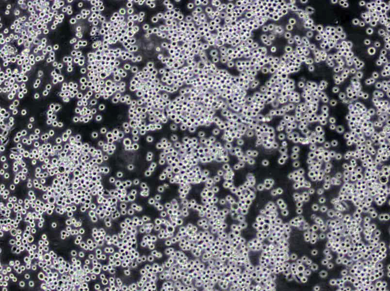 MAVER-1 Cells(赠送Str鉴定报告)|人淋巴细胞瘤细胞
