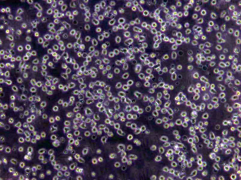Karpas-422 Cells(赠送Str鉴定报告)|人类B细胞淋巴瘤细胞
