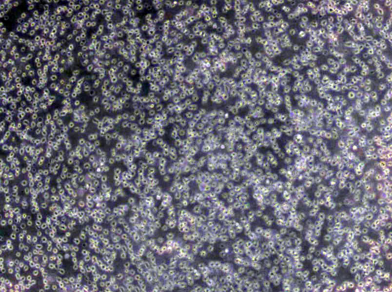 EB2 Cells(赠送Str鉴定报告)|人B淋巴细胞瘤细胞