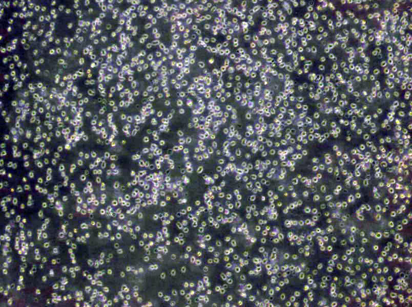 EB1 Cells(赠送Str鉴定报告)|人B淋巴细胞瘤细胞