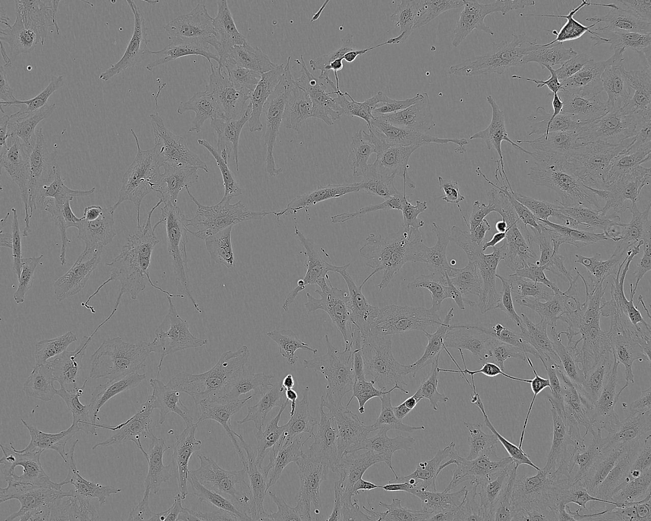 ELD-1 Cells(赠送Str鉴定报告)|人朗格汉斯细胞型树突状细胞