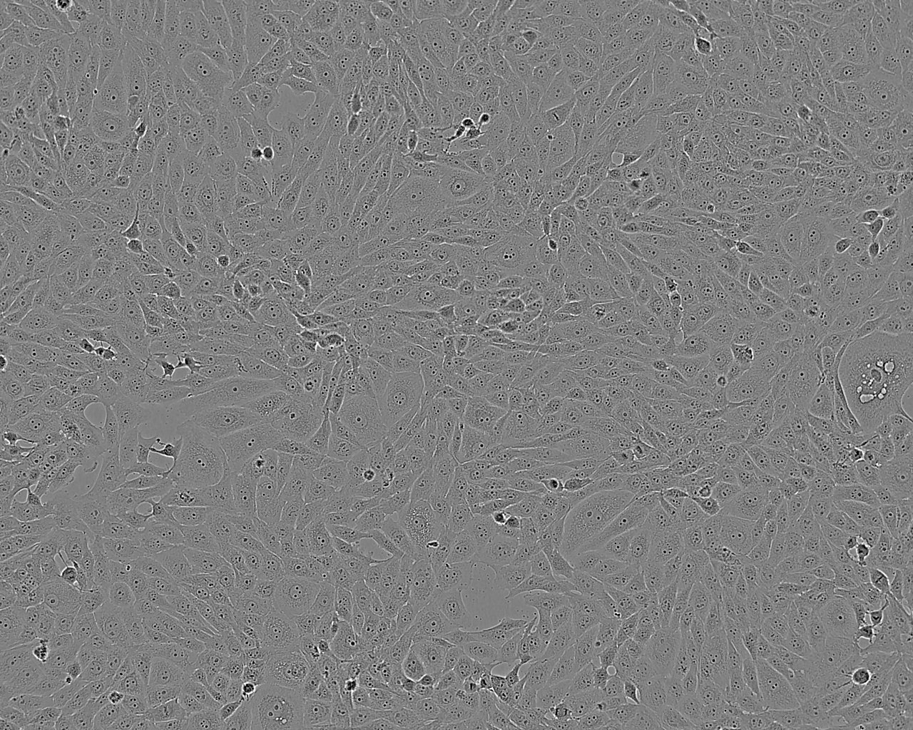 CHP-100 Cells|人成神经克隆细胞(包送STR鉴定报告)