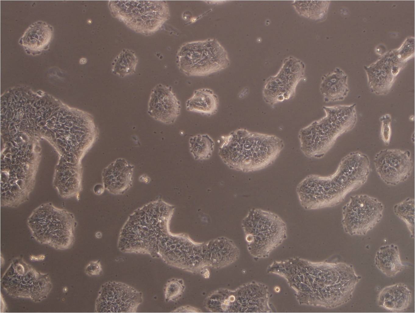 CAL-120 Cells(赠送Str鉴定报告)|人乳腺癌细胞