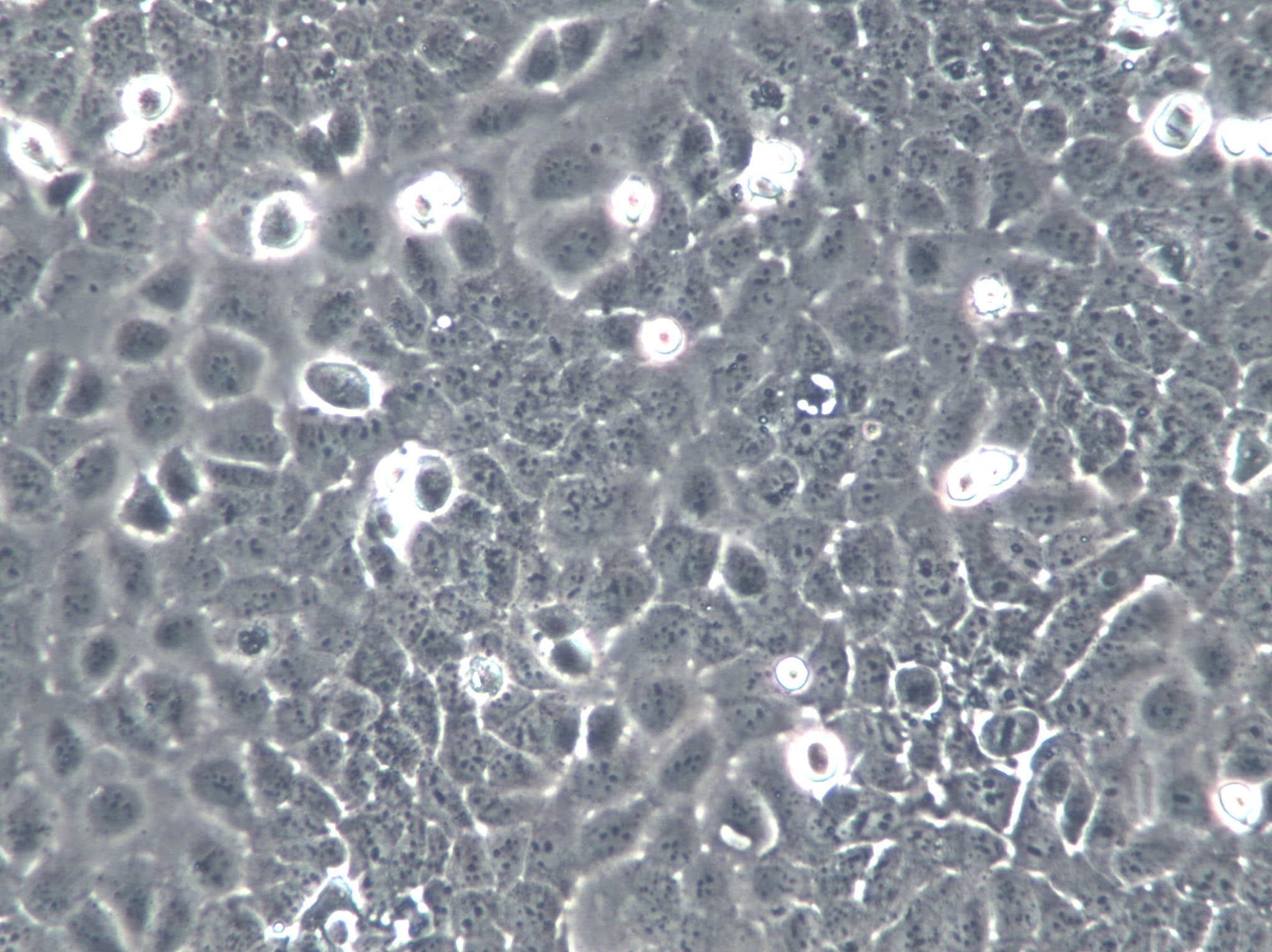 NCI-H1963 Cells|人小细胞肺癌克隆细胞(包送STR鉴定报告)