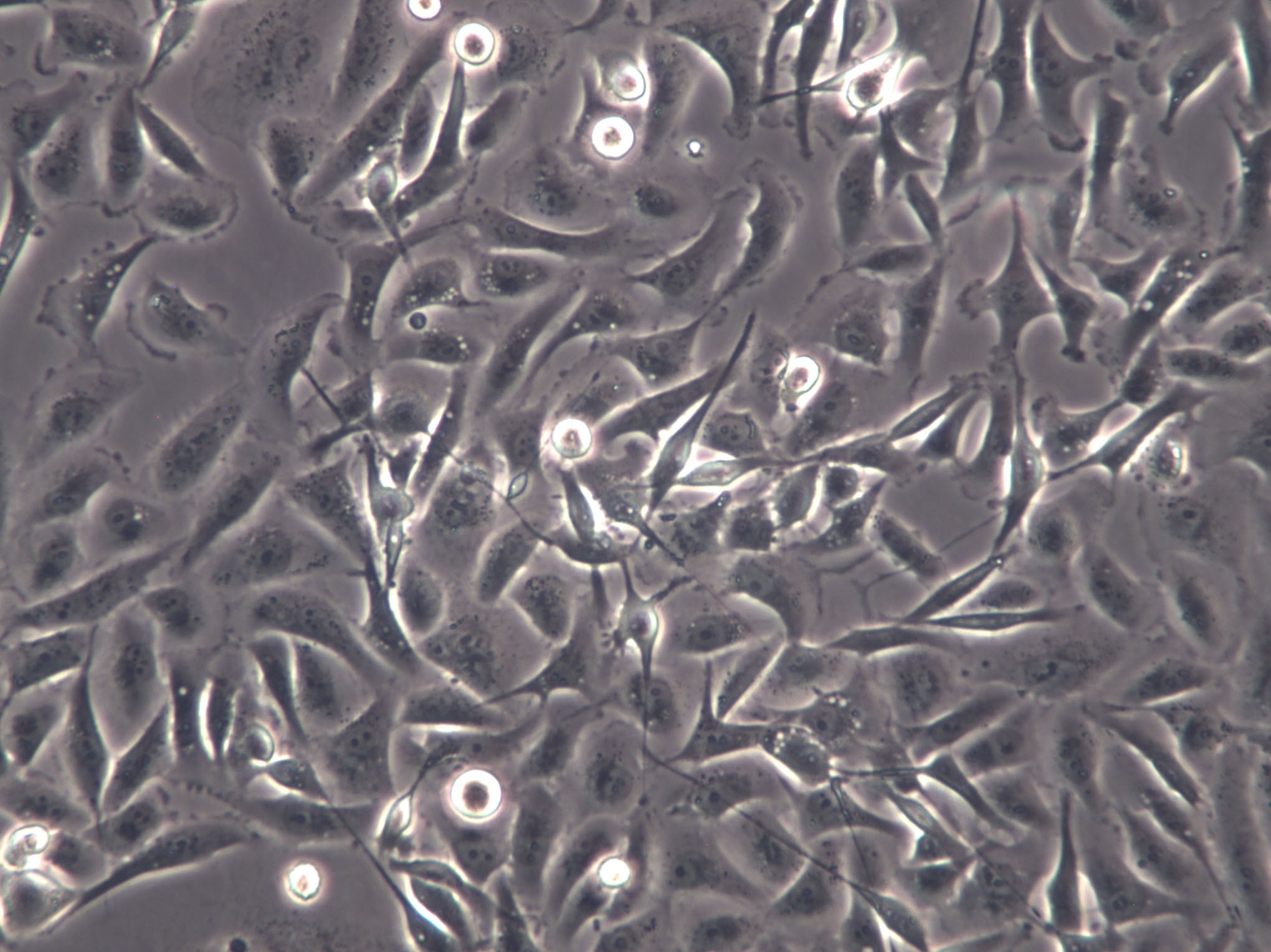 NCI-H1694 Cells|人小细胞肺癌克隆细胞
