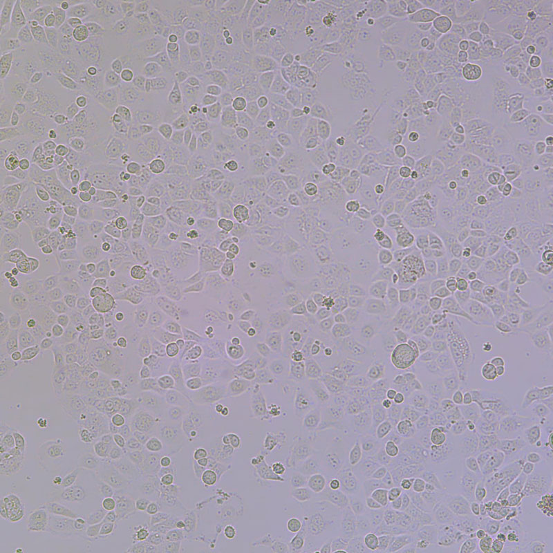 KLE（人子宫内膜腺癌细胞）