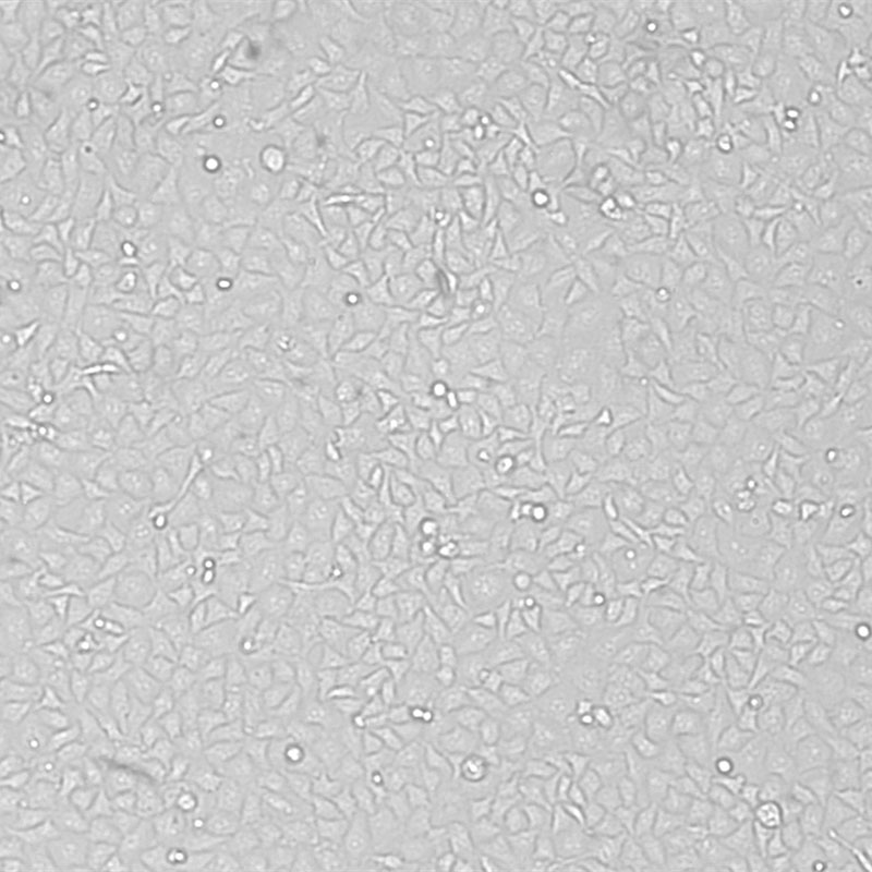 BEL-7402（人肝癌细胞）