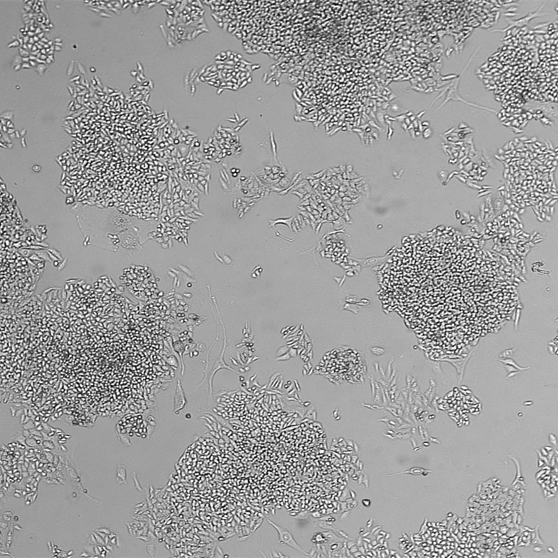 BEL-7404（人肝癌细胞）