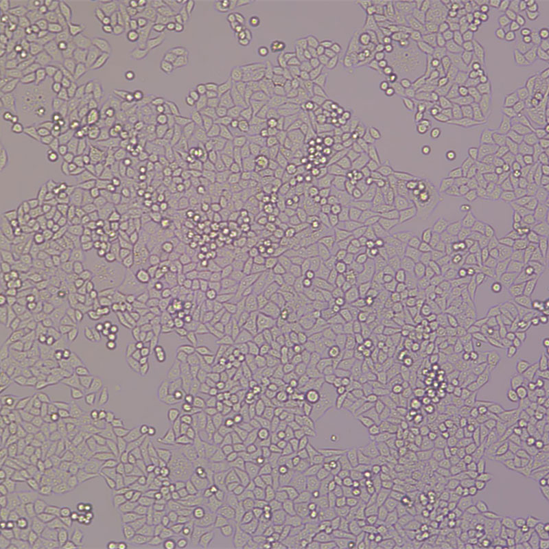 HL7702[L02]（人肝正常细胞）