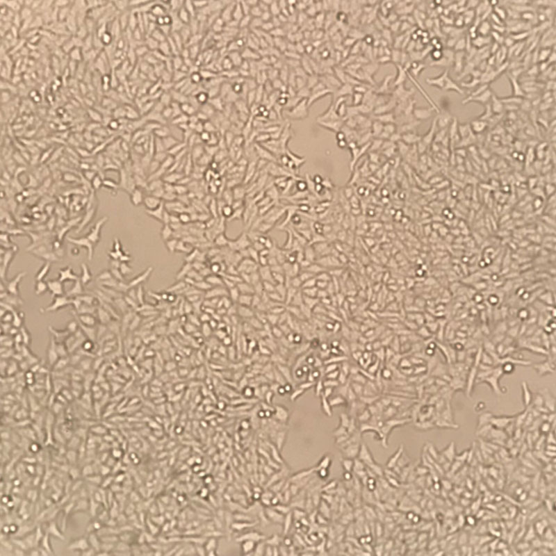 HEP-2（人喉表皮样癌细胞）